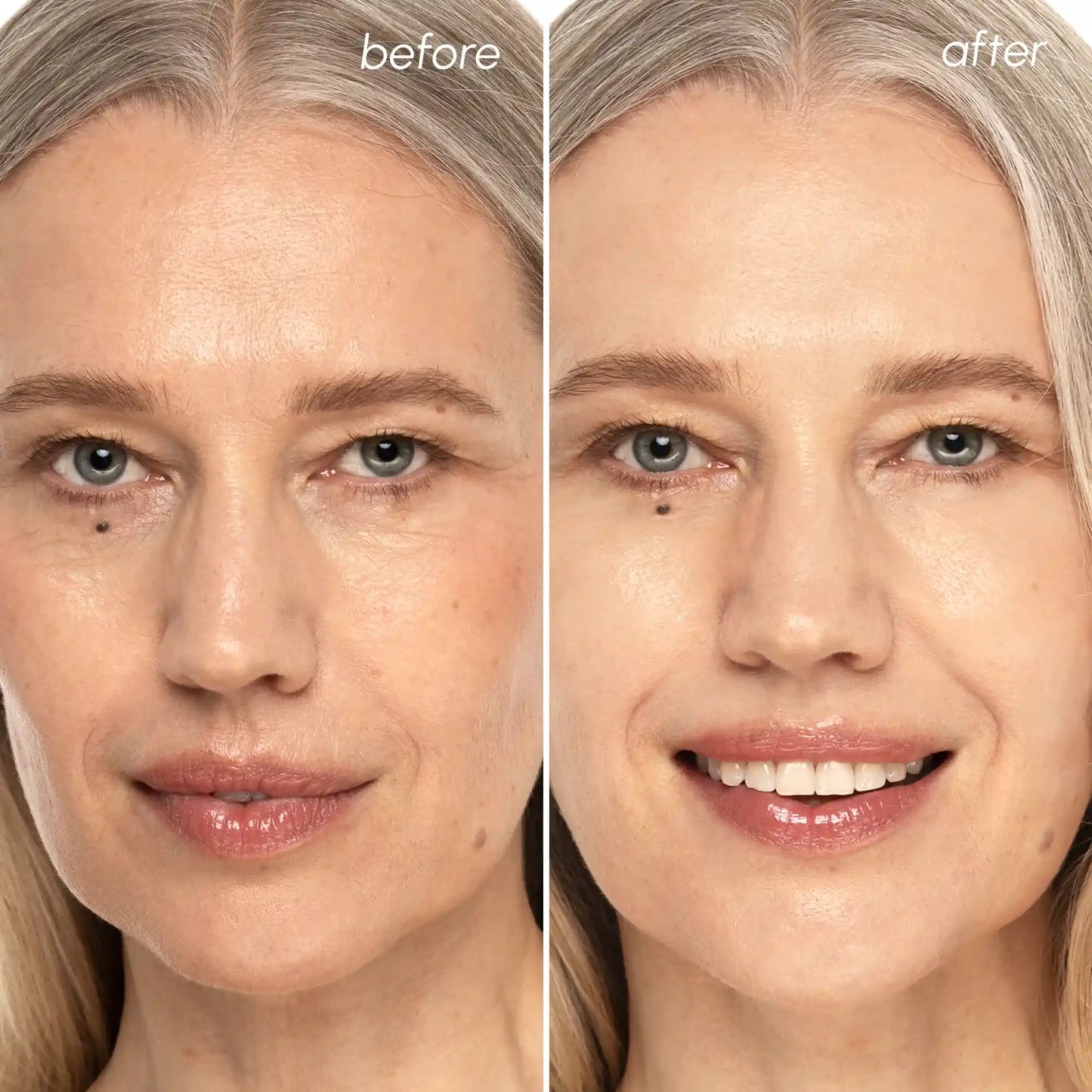 Collagen & Retinol Toner Pads — Anti-Aging Daily Exfoliating Treatment